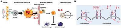 Defining the role of Interleukin-6 for the development of perioperative neurocognitive disorders: Evidence from clinical and preclinical studies